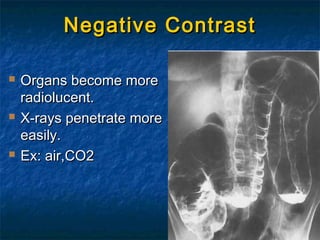 Negative ContrastNegative Contrast
 Organs become moreOrgans become more
radiolucent.radiolucent.
 X-rays penetrate moreX-rays penetrate more
easily.easily.
 Ex: air,CO2Ex: air,CO2
 