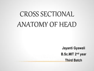 CROSS SECTIONAL
ANATOMY OF HEAD
Jayanti Gyawali
B.Sc.MIT 2nd year
Third Batch
 