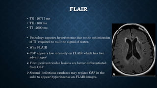 FLAIR
• TR : 10717 ms
• TE : 100 ms
• TI : 2000 ms
• Pathology appears hyperintense due to the optimization
of TI required to null the signal of water.
• Why FLAIR
 CSF appears low intensity on FLAIR which has two
advantages:
 First, periventricular lesions are better differentiated
from CSF
 Second , infectious exudates may replace CSF in the
sulci to appear hyperintense on FLAIR images.
 