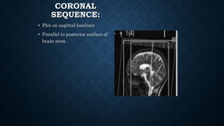 CORONAL
SEQUENCE:
• Plot on sagittal localizer
• Parallel to posterior surface of
brain stem
 