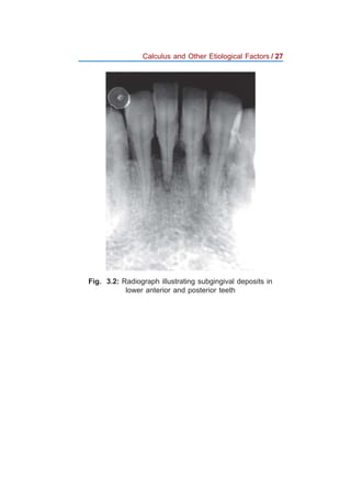 Jaypee mini atlas series periodontics | PDF