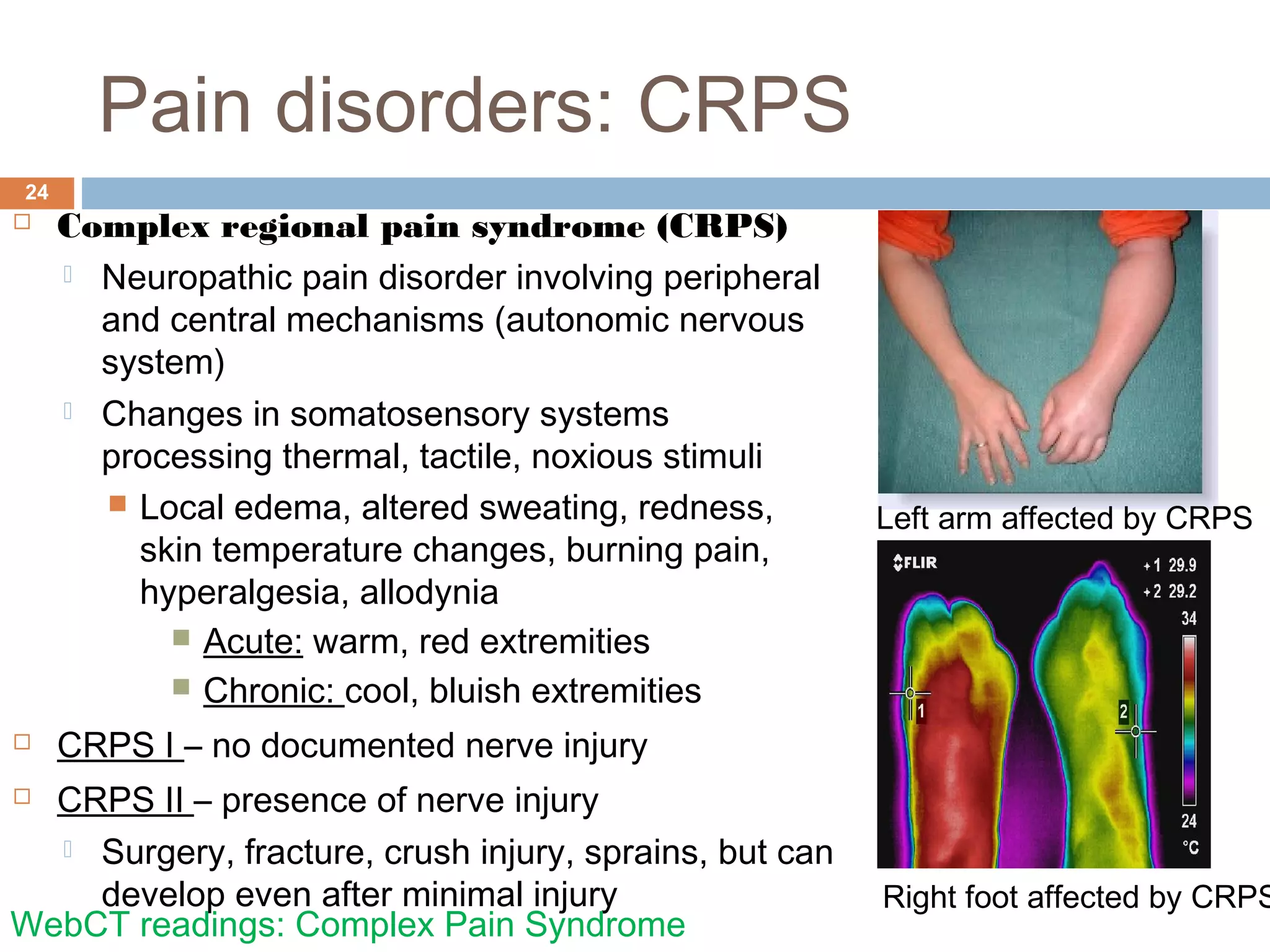Pain disorders: CRPS
24
 Complex regional pain syndrome (CRPS)
 Neuropathic pain disorder involving peripheral
and central mechanisms (autonomic nervous
system)
 Changes in somatosensory systems
processing thermal, tactile, noxious stimuli
 Local edema, altered sweating, redness,
skin temperature changes, burning pain,
hyperalgesia, allodynia
 Acute: warm, red extremities
 Chronic: cool, bluish extremities
 CRPS I – no documented nerve injury
 CRPS II – presence of nerve injury
 Surgery, fracture, crush injury, sprains, but can
develop even after minimal injury
WebCT readings: Complex Pain Syndrome
Left arm affected by CRPS
Right foot affected by CRPS
 