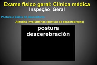 Exame físico geral: Clínica médica
Inspeção Geral
Postura e sinais de desconforto:
Atitudes involuntárias (postura de descerebração)
 
