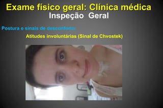 Exame físico geral: Clínica médica
Inspeção Geral
Postura e sinais de desconforto:
Atitudes involuntárias (Sinal de Chvostek)
 