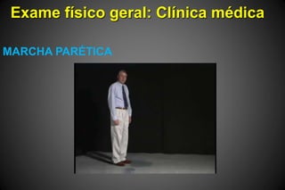 Exame físico geral: Clínica médica
MARCHA PARÉTICA
 