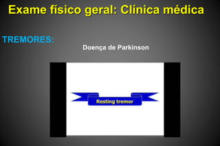 Exame físico geral: Clínica médica
TREMORES:
Doença de Parkinson
 