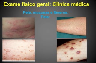 Exame físico geral: Clínica médica
Pele, mucosas e fâneros:
Pele:
 