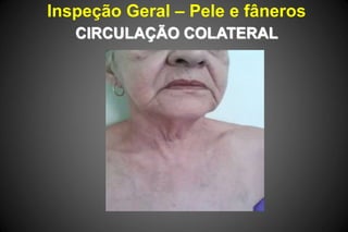 Inspeção Geral – Pele e fâneros
CIRCULAÇÃO COLATERAL
 