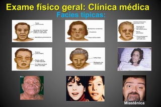 Exame físico geral: Clínica médica
Facies típicas:
Miastênica
 