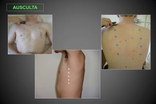 AUSCULTA
 