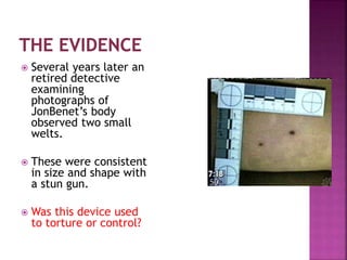  Several years later an
retired detective
examining
photographs of
JonBenet’s body
observed two small
welts.
 These were consistent
in size and shape with
a stun gun.
 Was this device used
to torture or control?
 