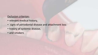 Exclusion criterion-
• relevant medical history,
• signs of periodontal disease and attachment loss
• history of systemic disease,
• and smokers
 