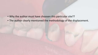 • Why the author must have choosen this particular site??
• The author clearly mentioned the methodology of the displacement.
 