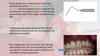 • Sulcal depth was measured by inserting a
periodontal probe (UNC-15; Hu-Friedy Mfg
Co, LLC) into the gingival sulcus opposite the
transitional line angles (TLA) and mid-buccal
areas of the tooth until slight resistance was
felt.
• Measurements were made at the TLA and
mid-buccal areas to rule out the presence of
periodontal pockets.
• On a diagnostic cast, an acrylic resin jig was
fabricated to fit over the mandibular teeth
to prop the mouth open and to stabilize the
mandible during assessment.
 