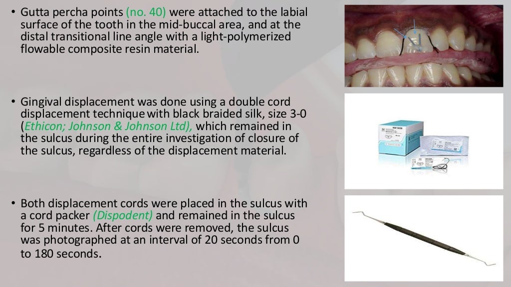 gingival retraction methods