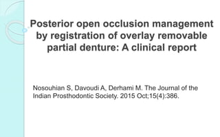 Posterior open occlusion management
by registration of overlay removable
partial denture: A clinical report
Nosouhian S, Davoudi A, Derhami M. The Journal of the
Indian Prosthodontic Society. 2015 Oct;15(4):386.
 