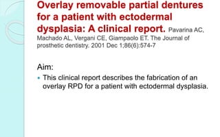 Overlay removable partial dentures
for a patient with ectodermal
dysplasia: A clinical report. Pavarina AC,
Machado AL, Vergani CE, Giampaolo ET. The Journal of
prosthetic dentistry. 2001 Dec 1;86(6):574-7
Aim:
 This clinical report describes the fabrication of an
overlay RPD for a patient with ectodermal dysplasia.
 