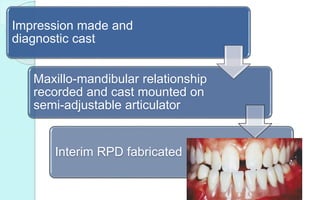 Impression made and
diagnostic cast
Maxillo-mandibular relationship
recorded and cast mounted on
semi-adjustable articulator
Interim RPD fabricated
 