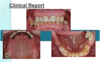 Clinical Report
 