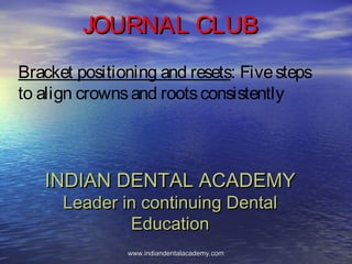Bracket positioning and resets: Fivesteps
to align crownsand rootsconsistently
JOURNAL CLUBJOURNAL CLUB
INDIAN DENTAL ACADEMYINDIAN DENTAL ACADEMY
Leader in continuing DentalLeader in continuing Dental
EducationEducation
www.indiandentalacademy.comwww.indiandentalacademy.com
 
