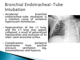  Accidental bronchial
endotracheal-tube intubation is
a common cause of unilateral
hyperlucent hemithorax.
 Hyperaeration of the i/l lung,
and the c/l lung may appear
collapsed, a result of generalized
hypoaeration and occlusion of its
main-stem bronchial orifice.
 Complications: ipsilateral
barotrauma from positive
pressure ventilation (eg,
pneumothorax) and hypoxia.
 