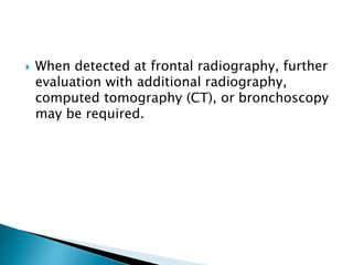  When detected at frontal radiography, further
evaluation with additional radiography,
computed tomography (CT), or bronchoscopy
may be required.
 