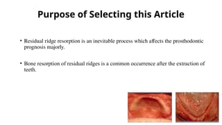 factors affecting residual ridge resoprtion | PPTX