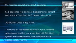 Pulp Blood Flow and Sensibility in Traumatized Teeth During Maxillary ...