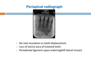 Jc 1 cbct findings of periapical cemento-osseous dysplasia-dr ...