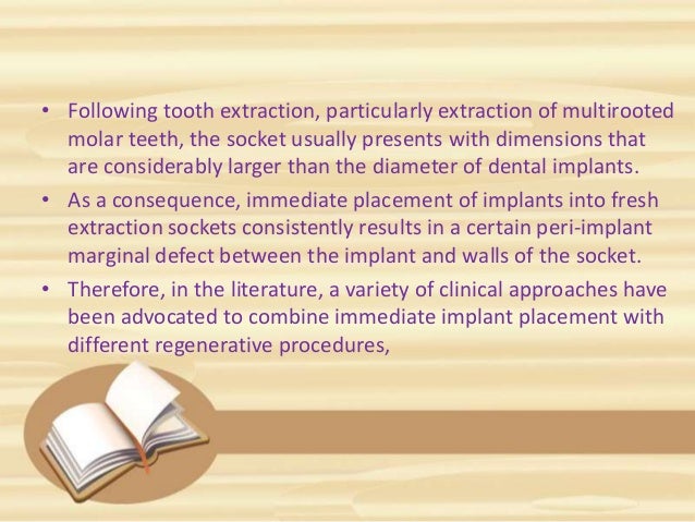 interradicular bone