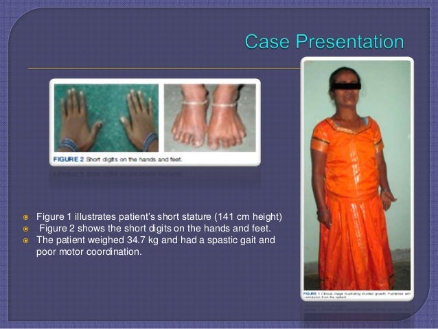 Fahr Syndrome- A Rare Case Report