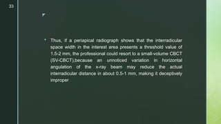 Interradicular Col X-ray beam angulation can compromise 2-dimensional diagnosis of ...