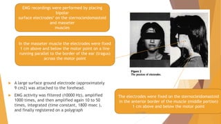  A large surface ground electrode (approximately
9 cm2) was attached to the forehead.
 EMG activity was filtered (10000 Hz), amplified
1000 times, and then amplified again 10 to 50
times, integrated (time constant, 1800 msec ),
and finally registered on a polygraph
EMG recordings were performed by placing
bipolar
surface electrodes* on the sternocleidomastoid
and masseter
muscles
The electrodes were fixed on the sternocleidomastoid
in the anterior border of the muscle (middle portion)
1 cm above and below the motor point
In the masseter muscle the electrodes were fixed
1 cm above and below the motor point on a line
running parallel to the border of the ear (tragus)
across the motor point
22-11-2020 49
 