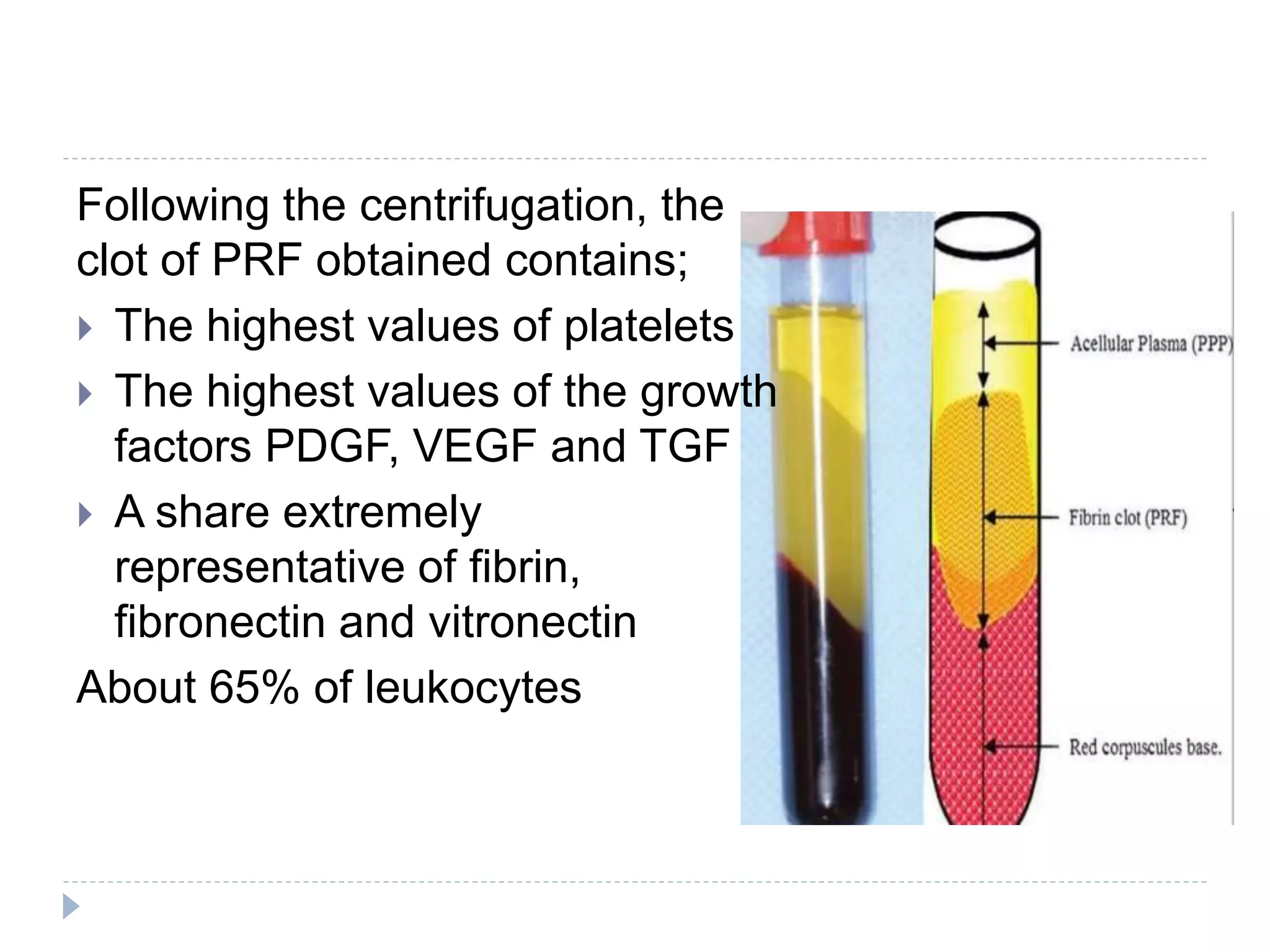 Introduction to Platelet Rich Fibrin (PRF) and its uses in Dentistry | PPTX