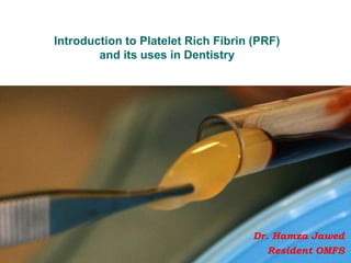 Introduction to Platelet Rich Fibrin (PRF)
and its uses in Dentistry
Dr. Hamza Jawed
Resident OMFS
 