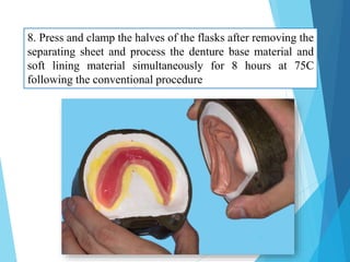 8. Press and clamp the halves of the flasks after removing the
separating sheet and process the denture base material and
soft lining material simultaneously for 8 hours at 75C
following the conventional procedure
20
 