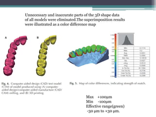 Unnecessary and inaccurate parts of the 3D shape data
of all models were eliminated.The superimposition results
were illustrated as a color difference map
Max +100µm
Min -100µm
Effective range(green)
-30 μm to +30 μm.
 