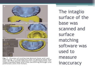 The intaglio
surface of the
base was
scanned and
surface
matching
software was
used to
measure
inaccuracy
 