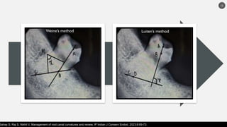 journal club presented minimally invasive endodontics | PPTX