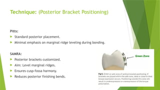 Bracket positioning PAST AND PRESENT SAP AND SAMRA.pptx