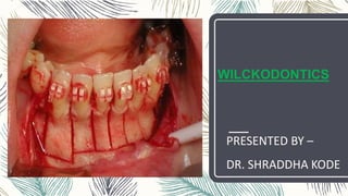 WILCKODONTICS
PRESENTED BY –
DR. SHRADDHA KODE
 