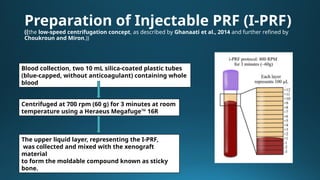 Comparative Study on Xenograft and Injectable PRF for Periodontal ...