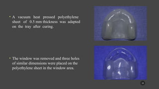 Flabby Ridge Radiograph managemnet of the flabby ridge using a modified technique.pptx