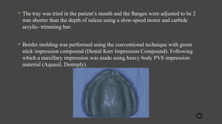 Flabby Ridge Radiograph managemnet of the flabby ridge using a modified technique.pptx