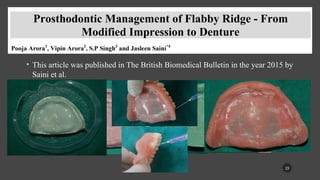 Flabby Ridge Radiograph managemnet of the flabby ridge using a modified technique.pptx