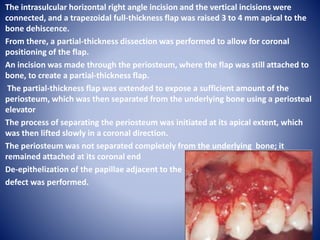 Circumcoronal Incision Multiple Gingival Recession Defects | PPTX