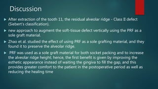 Siberet Ridge Defect JOURNAL CLUB PRESENTATION IN PROSTHODONTICS ON PLATELET RICH FACTOR | PPTX