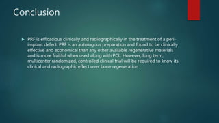 JOURNAL CLUB PRESENTATION IN PROSTHODONTICS ON PLATELET RICH FACTOR | PPTX