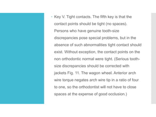 Tooth Contact Exceptions The six keys to normal occlusion | PPTX