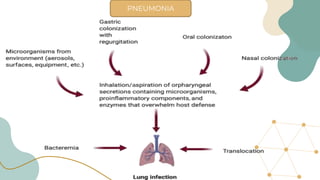 PNEUMONIA
 